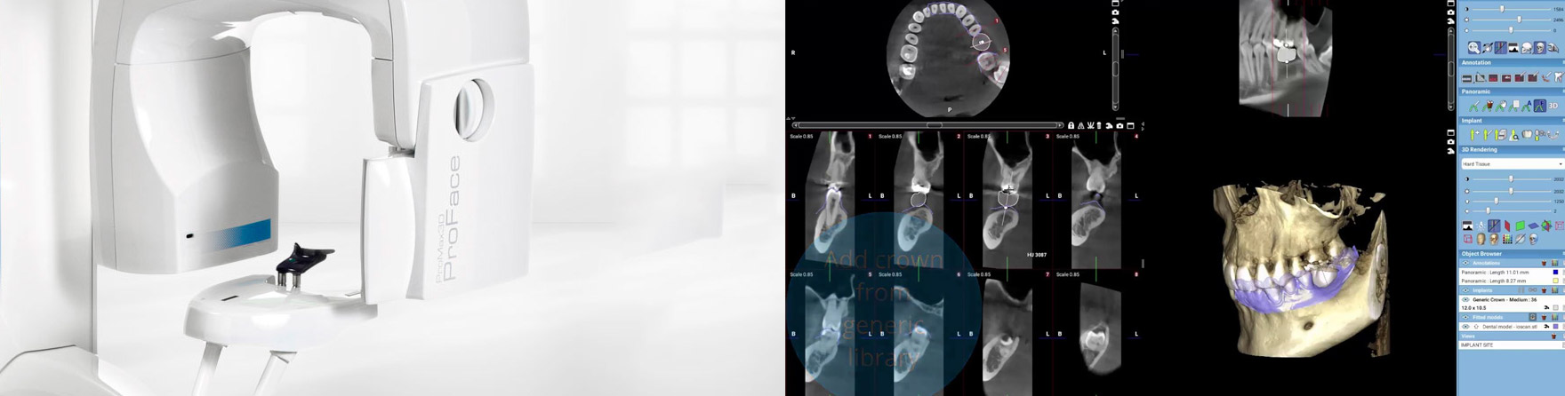 3d diagnostik
