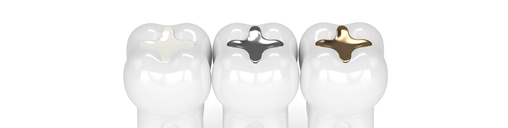 amalgam sanierungen